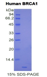 RPB376Hu01.jpg