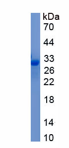 Recombinant Protein Kinase C Zeta (PKCz)