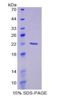 Recombinant Neutrophil gelatinase-associated lipocalin (NGAL)