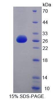 RPB398Hu01.jpg