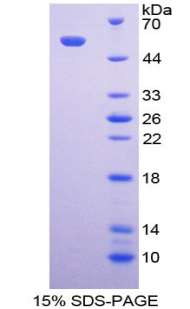 RPB402Hu01.jpg