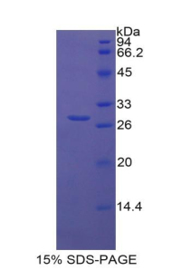 Recombinant Lipopolysaccharide Binding Protein (LBP)