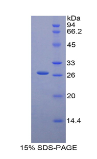 Recombinant Glucuronidase Beta (GUSb)