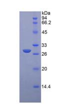 Recombinant Glucuronidase Beta (GUSb)