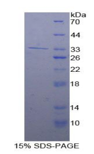 Recombinant Adenylate Cyclase 9 (ADCY9)