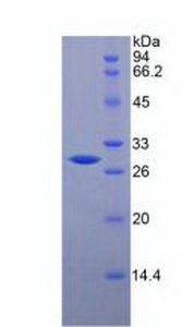 Recombinant Chitinase-3-like Protein 1 (CHI3L1)