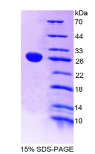 Recombinant Tumor Necrosis Factor Receptor Superfamily, Member 1B (TNFRSF1B)