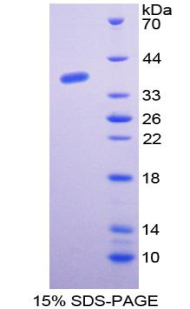 Recombinant General Transcription Factor IIE, Polypeptide 1 (GTF2E1)