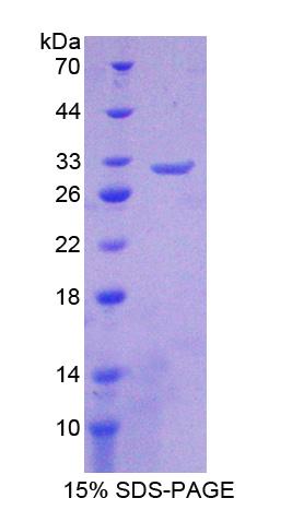 Recombinant Cholinergic Receptor, Nicotinic, Beta 2 (CHRNb2)