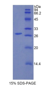 Recombinant Interleukin 1 Receptor Associated Kinase 1 (IRAK1)