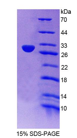 Recombinant Neuronal Apoptosis Inhibitory Protein (NAIP)