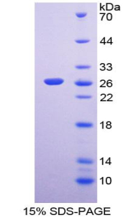 RPB537Hu01.jpg