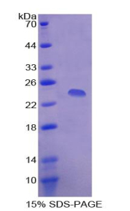 RPB539Hu01.jpg