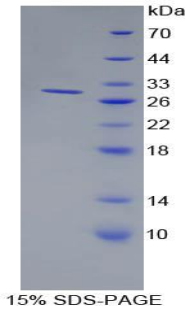 RPB551Hu01.jpg