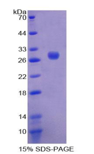 RPB554Hu01.jpg