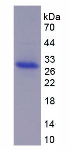 RPB555Hu01.jpg