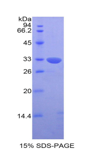 Recombinant Killer Cell Immunoglobulin Like Receptor 2DS4 (KIR2DS4)