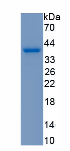 Recombinant Interferon Regulatory Factor 1 (IRF1)