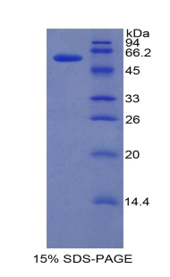 Recombinant Interferon Regulatory Factor 1 (IRF1)