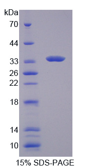 RPB595Hu01.jpg