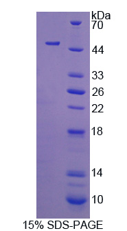 RPB597Hu01.jpg