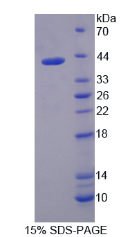 Recombinant Interferon Regulatory Factor 5 (IRF5)