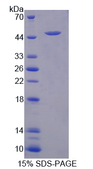 RPB628Hu01.jpg