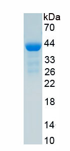 Recombinant Trefoil Factor 3 (TFF3)