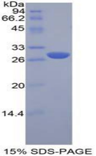 Recombinant Lymphocyte Activation Gene 3 (LAG3)