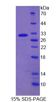 RPB669Hu01.jpg