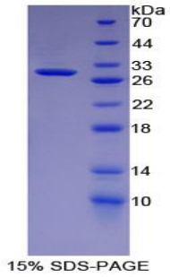 Recombinant Suppressors Of Cytokine Signaling 3 (SOCS3)