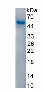 Recombinant Alpha-1-Antitrypsin (a1AT)