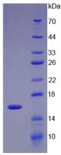 Recombinant UDP Glucose Ceramide Glucosyltransferase (UGCG)