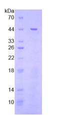 Recombinant Signal Transducer And Activator Of Transcription 3 (STAT3)