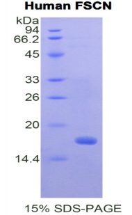 Recombinant Fascin (FSCN)