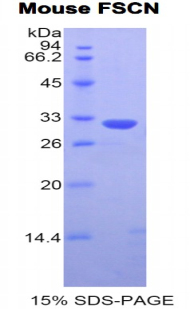 Recombinant Fascin (FSCN)