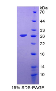 Recombinant Prekallikrein (PK)