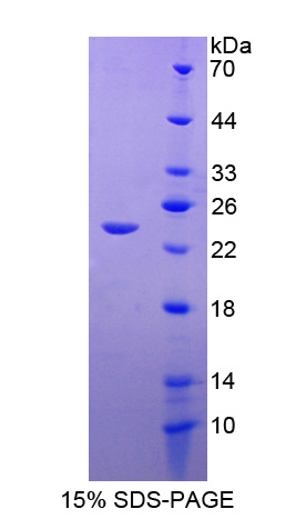 RPB814Hu01.jpg