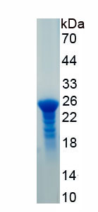 RPB815Hu01.jpg