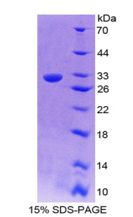 Recombinant Complement Component 9 (C9)