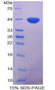 RPB824Hu02.jpg