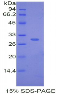 Recombinant Complement Factor D (CFD)