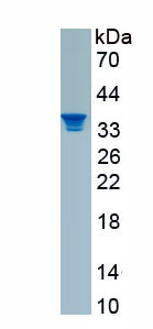 Recombinant Interleukin 2 Receptor Alpha (IL2Ra)