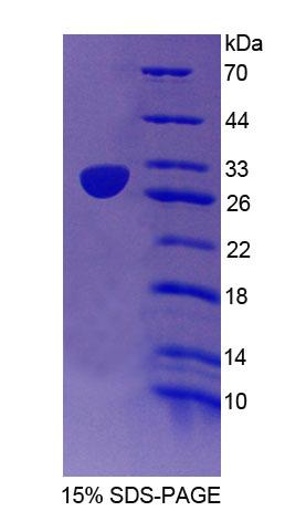 RPB843Hu01.jpg