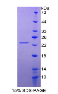 Recombinant Fibroblast Growth Factor 10 (FGF10)