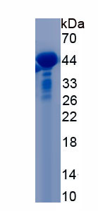 Recombinant Angiotensin I Converting Enzyme 2 (ACE2)