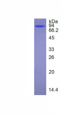 Recombinant Angiotensin I Converting Enzyme 2 (ACE2)