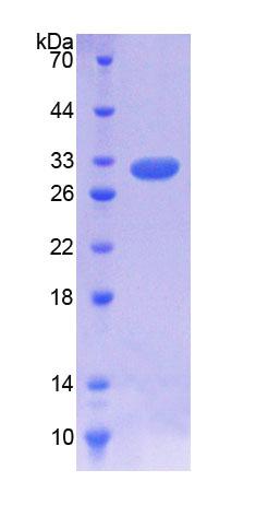 Recombinant Interleukin 7 Receptor (IL7R)