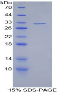 Recombinant S Antigen (SAG)