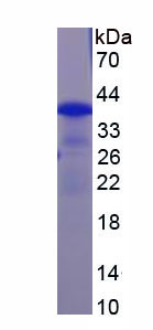 Recombinant A Disintegrin And Metalloproteinase With Thrombospondin 1 (ADAMTS1)